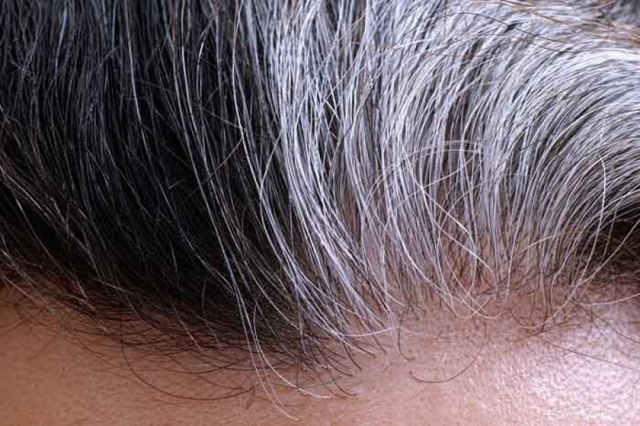 دلایل سفیدشدن مو و روش جلوگیری از آن