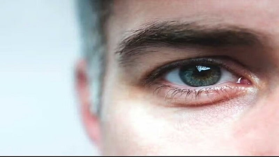 کم‌خوابی، تهدیدی جدی برای سلامت چشم‌ها
