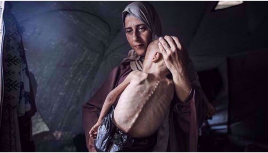 Six autres Palestiniens, dont un enfant, meurent de faim à Gaza